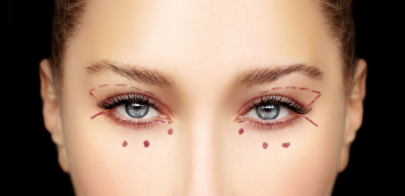 Lower Blepharoplasty.Upper blepharoplasty.Marking the face.Perforation lines on females face, plastic surgery concept.